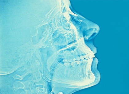 Head X-ray